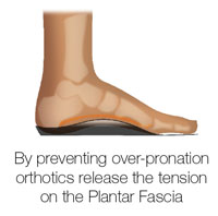 orthotics for arch pain
