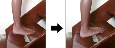 Plantar Fasciitis exercise 4