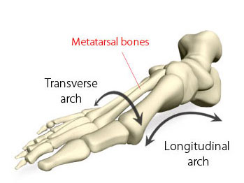 arches of the foot
