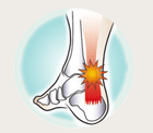 Achilles Tendonitis