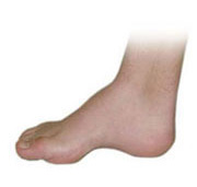 high arch foot