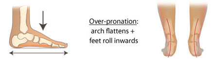 pronation arch flattens feet roll inwwards
